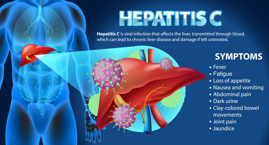 Different Types of Hepatitis and How to Prevent Them - Life Conceptual