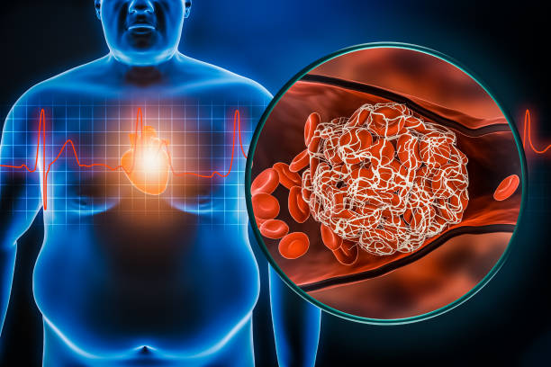 Heart Failure and Obesity