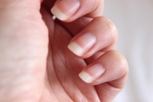 Nail Growth