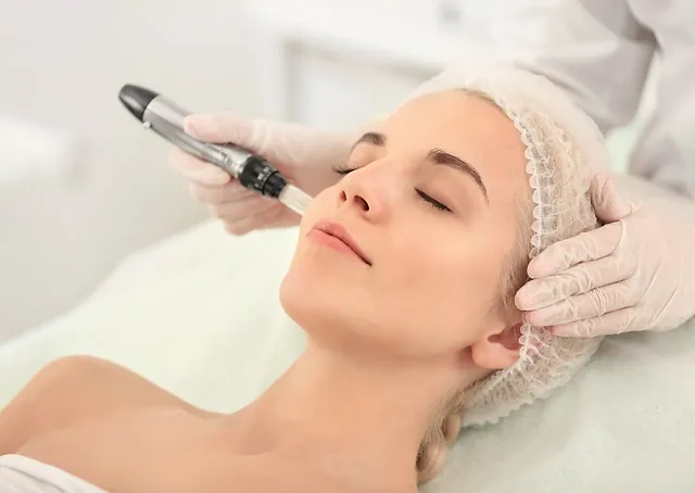 Microneedling Wonders