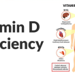 Vitamin D Deficiency: Across Age Groups Explained by Dr. Valter Longo
