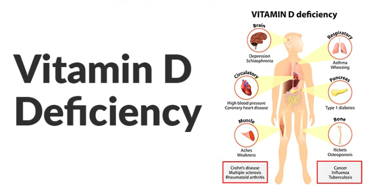 Vitamin D Deficiency: Across Age Groups Explained by Dr. Valter Longo