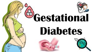 Gestational Diabetes