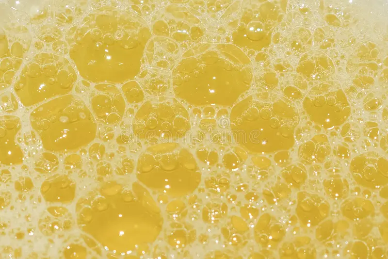 Beer-Like Urine