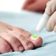 What to Know About Laser Treatment For Toenail Fungus