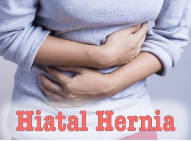 Hiatal Hernia