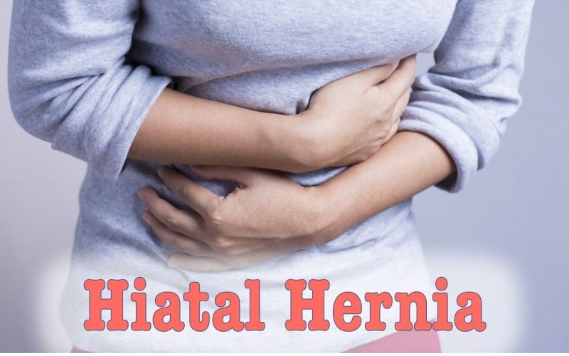 Hiatal Hernia