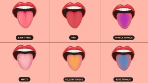 Tongue Color Variations