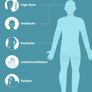 Spotting Heat Rash