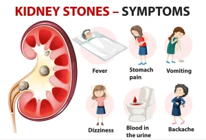 Kidney Stones