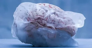 Origins of Brain Freeze