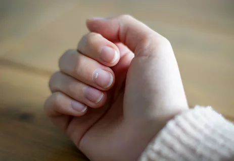 White Spots on Nails