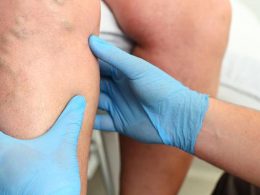 Vein Clinic Oakbrook