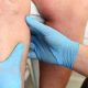 Vein Clinic Oakbrook