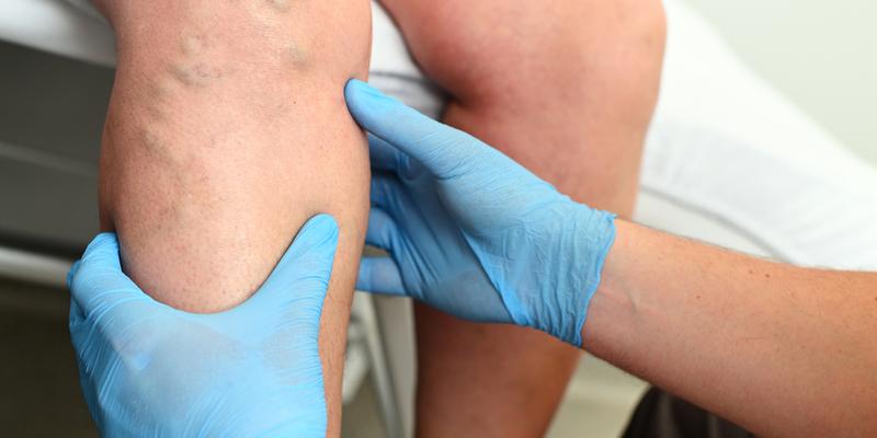 Vein Clinic Oakbrook