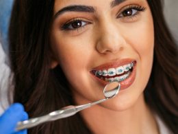 Best Orthodontist Near Me: Transform Your Smile