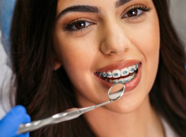 Best Orthodontist Near Me: Transform Your Smile