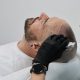Scalp Micropigmentation Dubai